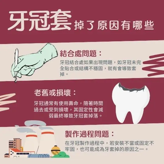 牙冠套掉了需立即處理,專業醫師建議盡快就診,避免進一步損害 1 6 13https www.gemini dental.tw the dental crown fell off