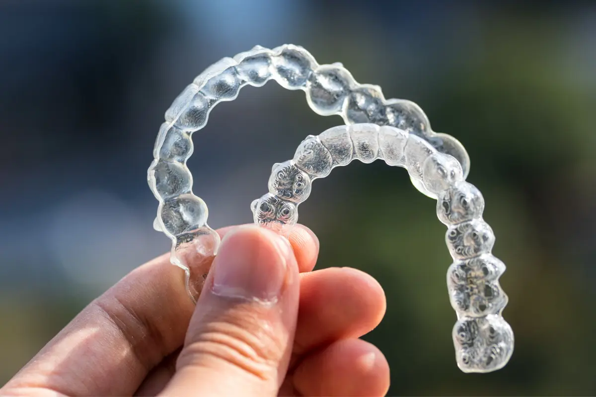 invisalign03 invisalign03