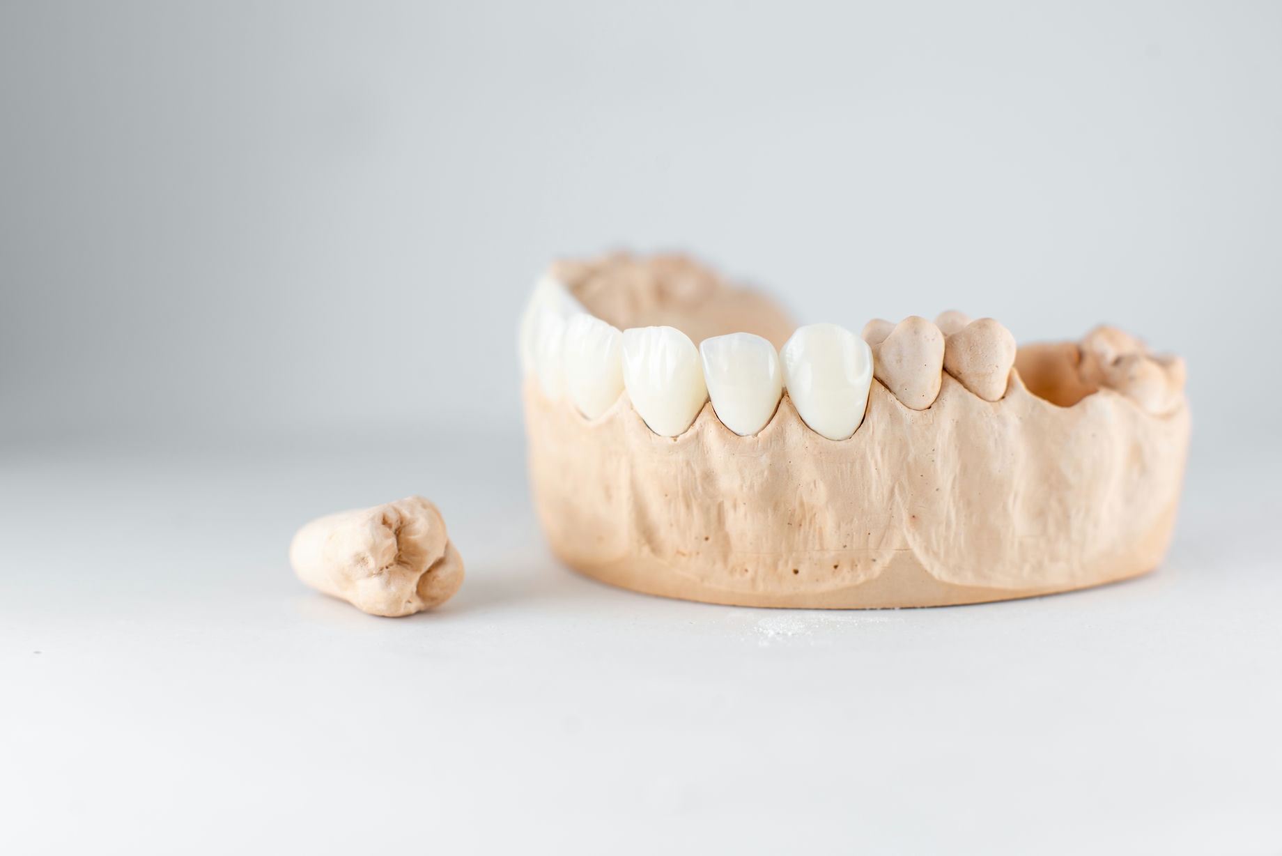 model-of-artificial-jaw-and-tooth-on-the-white-bac-2021-09-01-14-47-45-utc model-of-artificial-jaw-and-tooth-on-the-white-bac-2021-09-01-14-47-45-utc