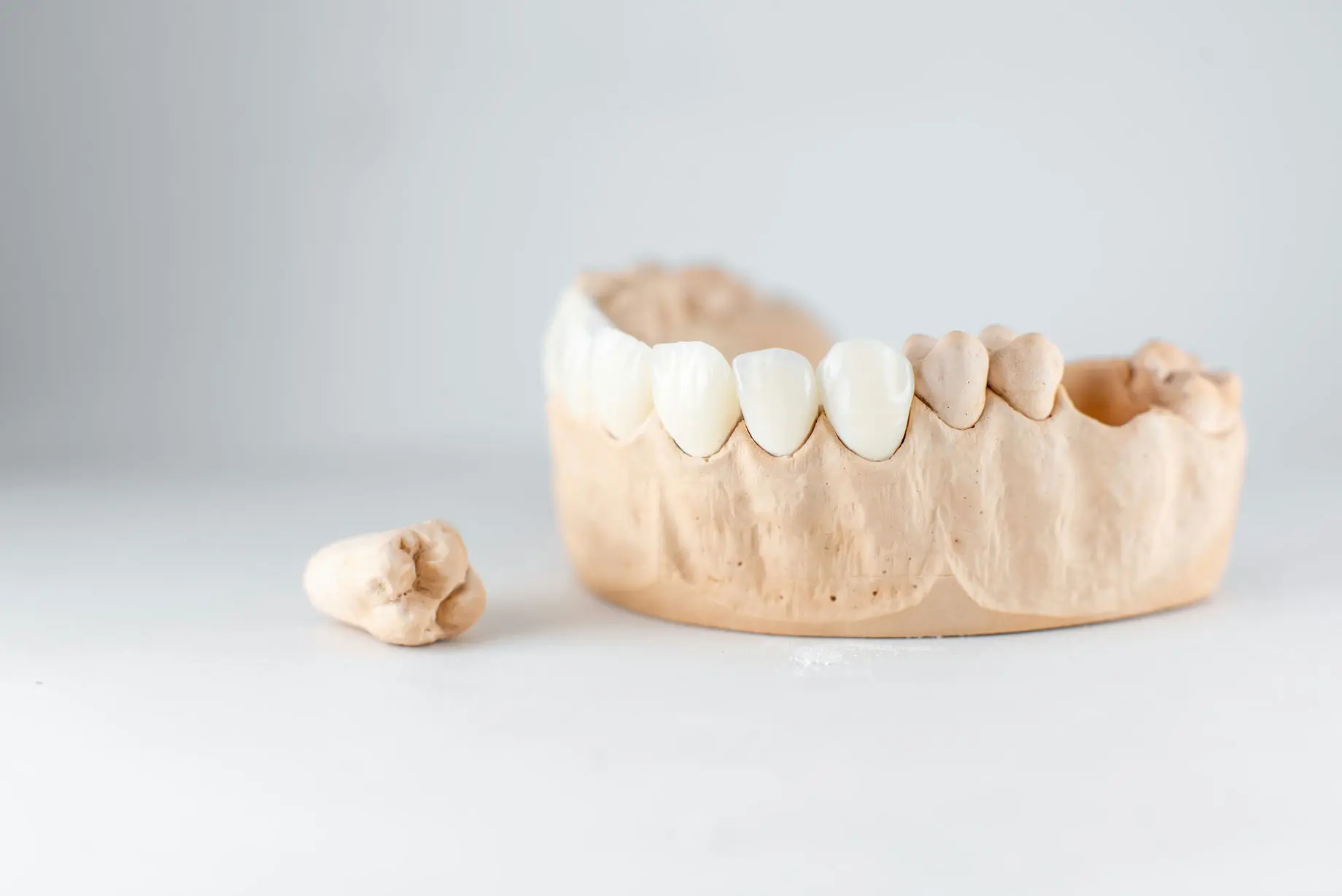 model-of-artificial-jaw-and-tooth-on-the-white-bac-2021-09-01-14-47-45-utc