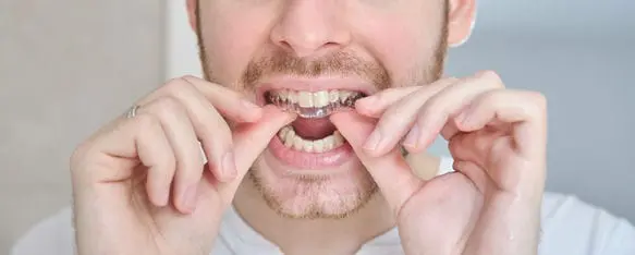 矯正牙齒後遺症怎麼避免?不矯正更麻煩 3 unrecognizable young latin man adjusting orthodont 2022 09 03 00 27 08 utc