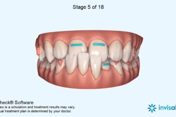 1676528812129 1676528812129