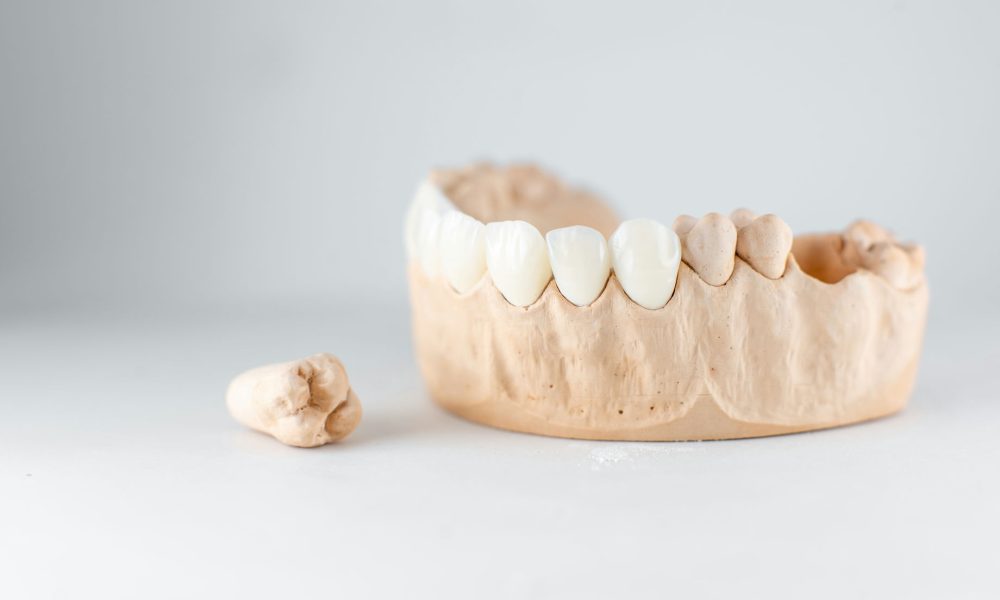 model-of-artificial-jaw-and-tooth-on-the-white-bac-2021-09-01-14-47-45-utc